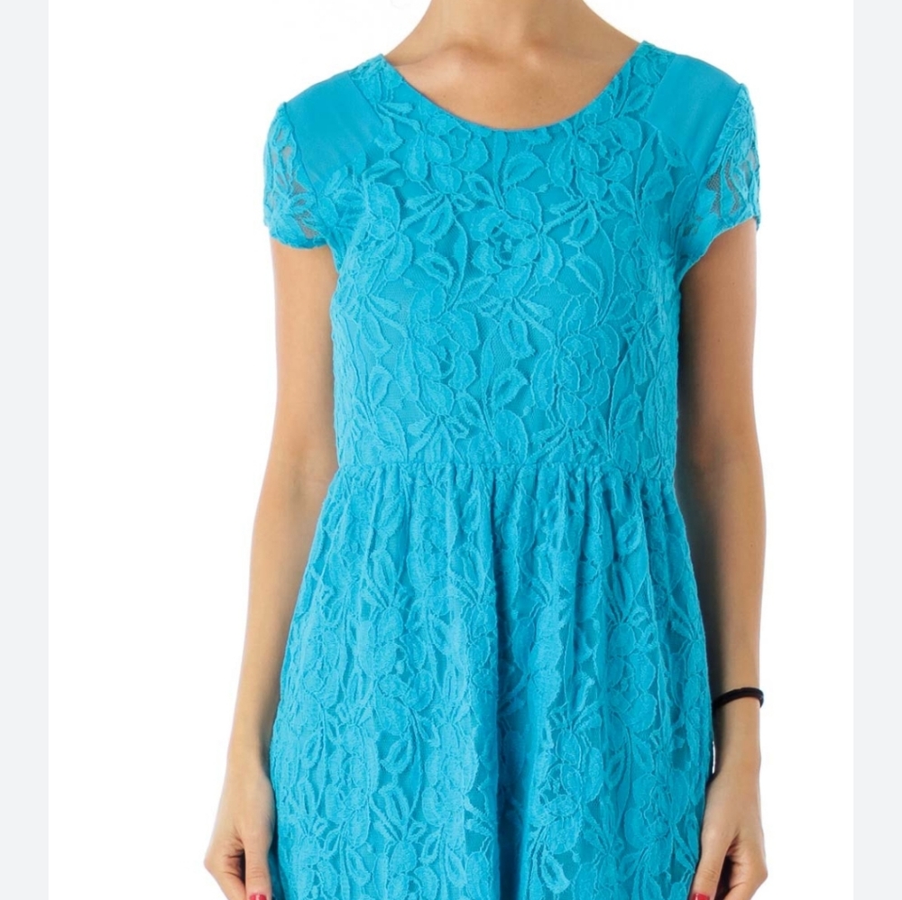 Coincidence & chance anthropologie lace dress medium *A - Picture 7 of 8
